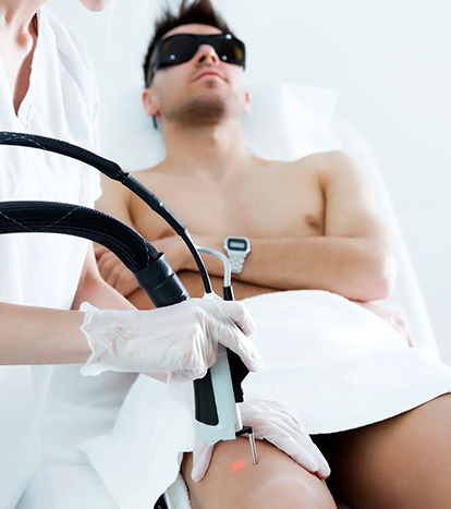 Bacak Lazer Epilasyon