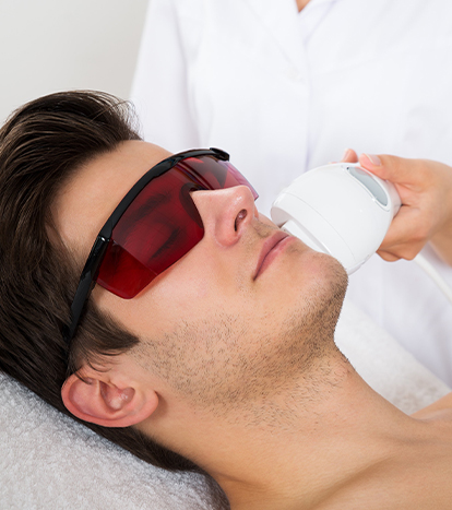 Yüz Lazer Epilasyon